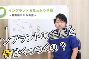 インプラントの金属と骨はくっつくの？
